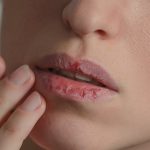 Cara Ampuh Menjaga Bibir Tetap Lembap & Sehat Selama Puasa