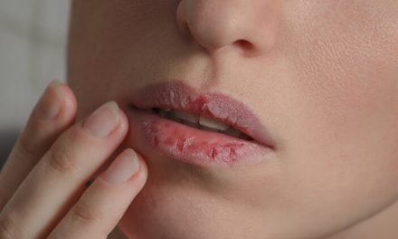 Cara Ampuh Menjaga Bibir Tetap Lembap & Sehat Selama Puasa